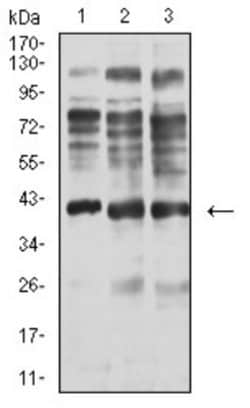 Centaurin alpha 1 Antibody (3E2D9) - BSA Free, Novus Biologicals 0.1 ml;